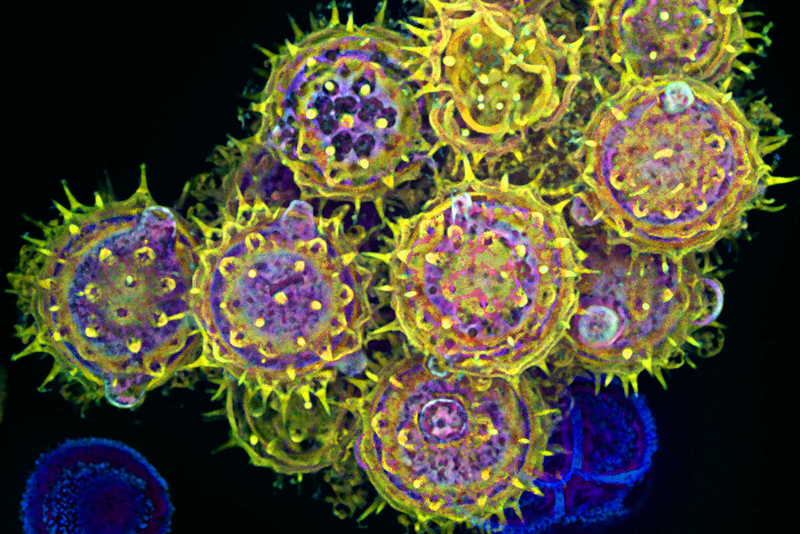 Illustration for article titled The Astounding And Horrific World As Seen Under A Microscope